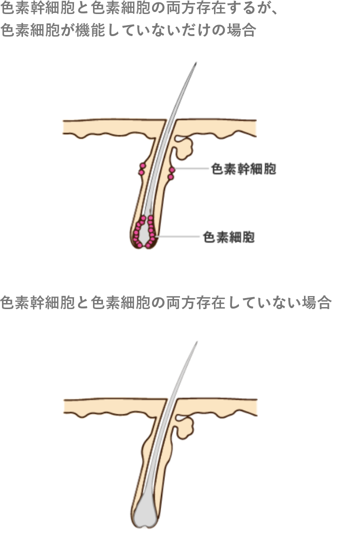 白髪予防について 美髪メソッド ホーユーダイレクト